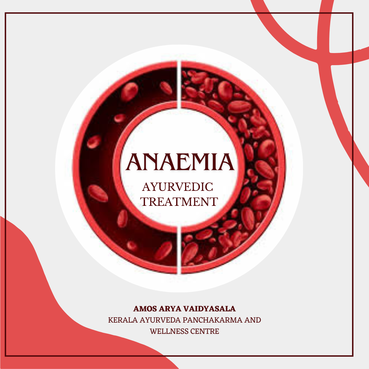 Anaemia Treatment in ayurveda 